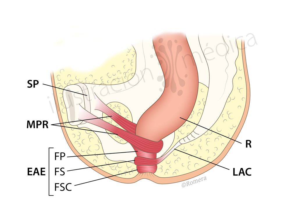 anatomia anatomy pelvis surgery RECTUM cirugia ilustracion medica medical illustration
