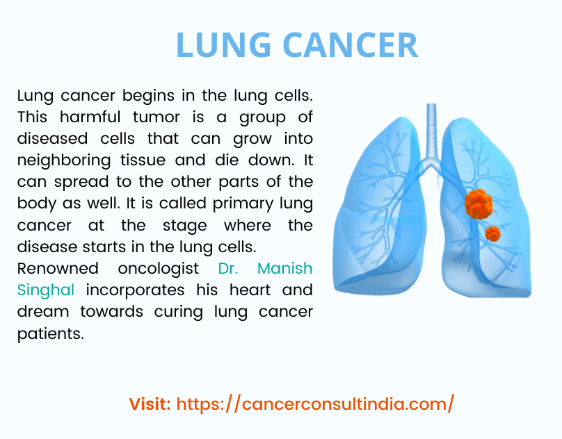 Lung Cancer Doctor in Delhi NCR