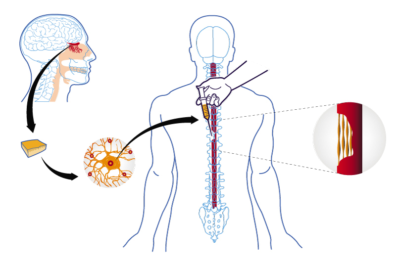 diagram infographic Illustrator design Transplant medulla