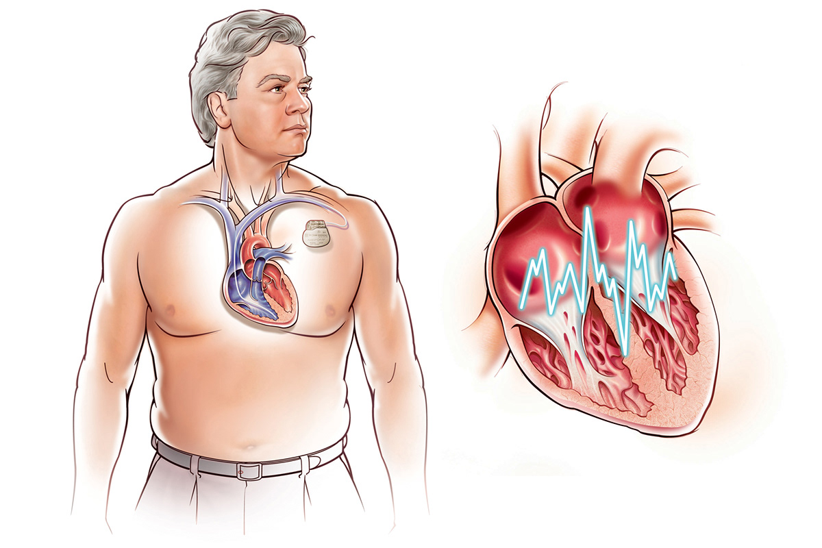 medical medical illustration product illustration product How To Illustration vector 3d animation line and color Heart Valves heart illustration Ear Illustration 