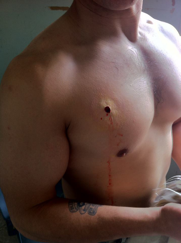 army scrapes Cuts gunshots impale makeup medic trauma Triage training