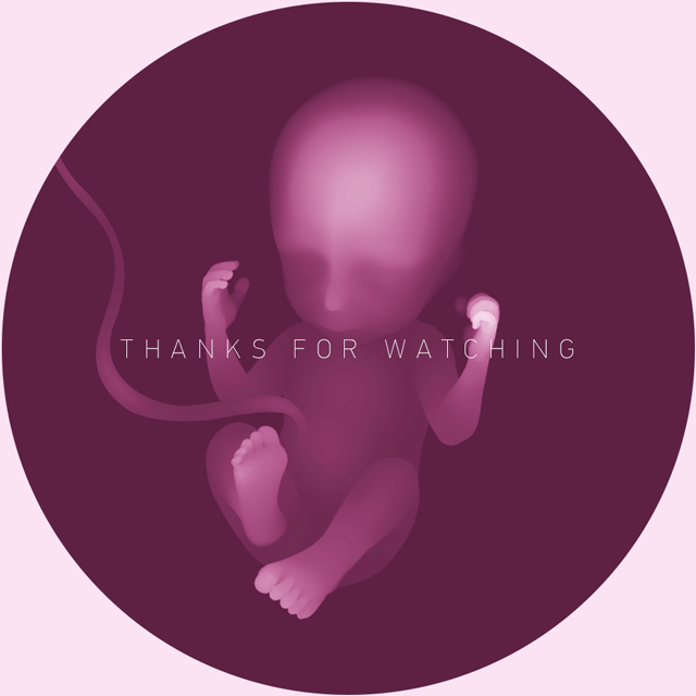 pregnancy Bayer fetus Ultrasound