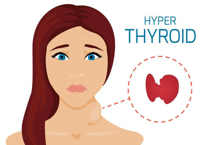 females thyroid Thyroid Effects