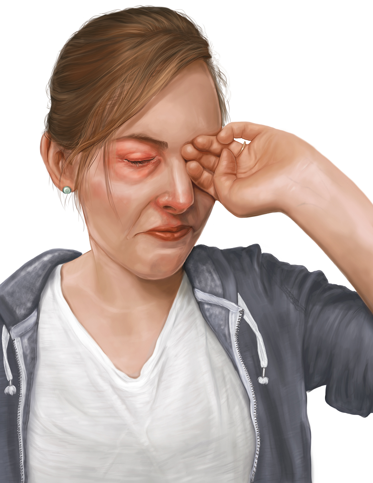 molecular illustration histamine allergies