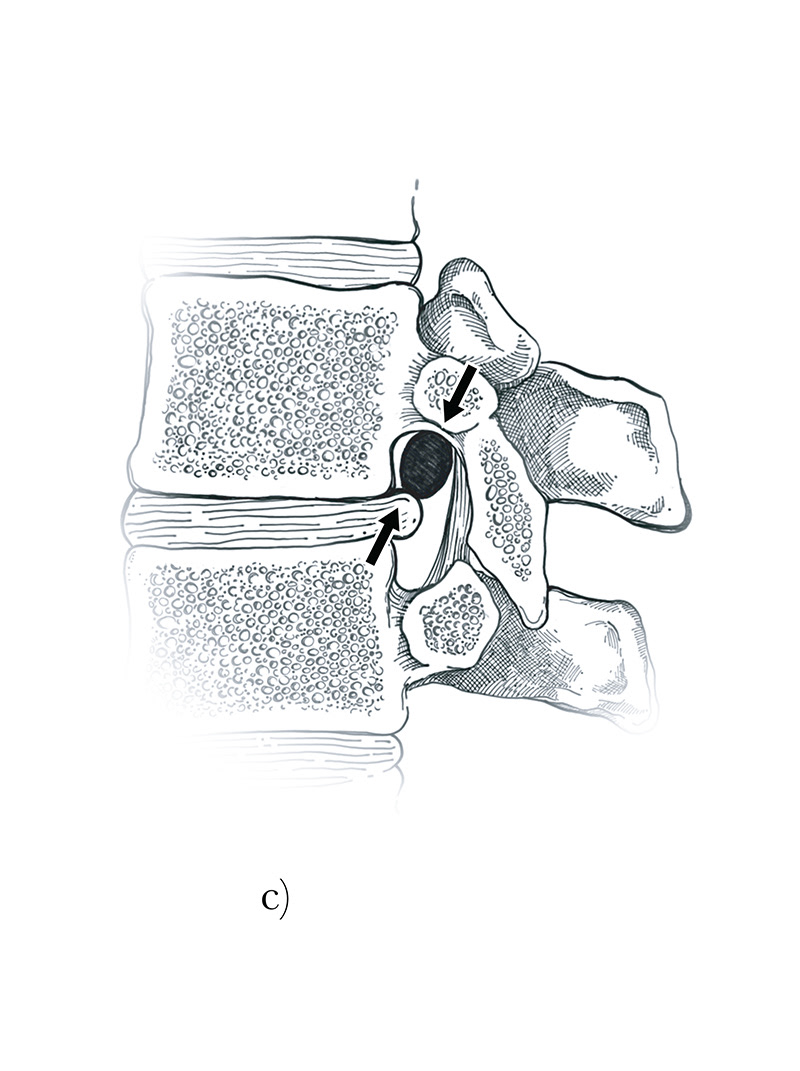 anatomy digital illustration medical illustration neuroanatomy spinal cord