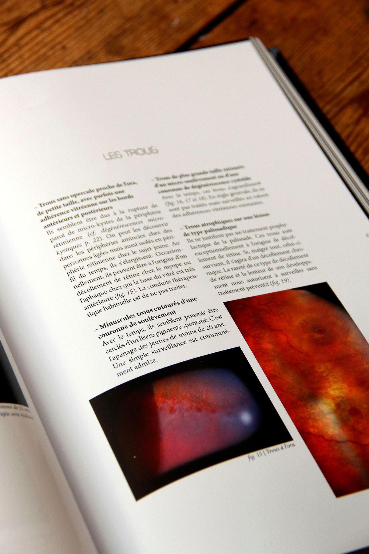 mise en page  page setting atlas  ophalmologie  400 pages épuré simplicité
