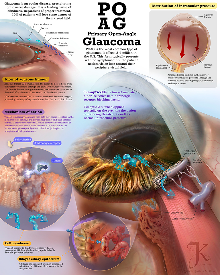 medical art pathology anatomy lungs eye Glaucoma heart stethoscope murmur concept CORONARY Tricuspid aorta
