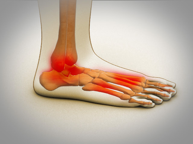 brokenfoot foot pain