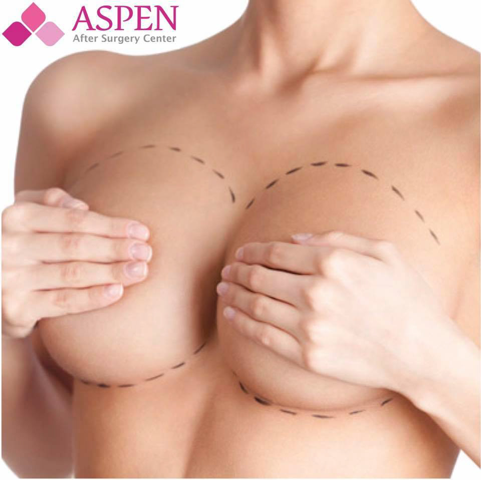 breast augmentation breast implant