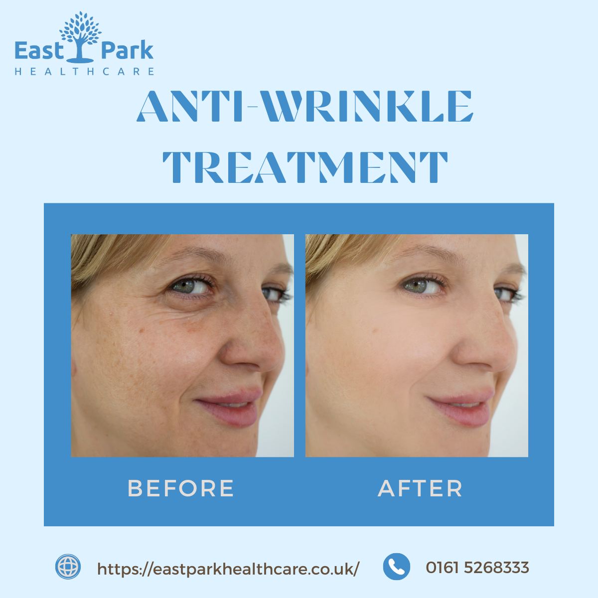 Wrinkle treatment clinic anti wrinkle treatment anti wrinkle treatments WRINKLE TREATMENTs
