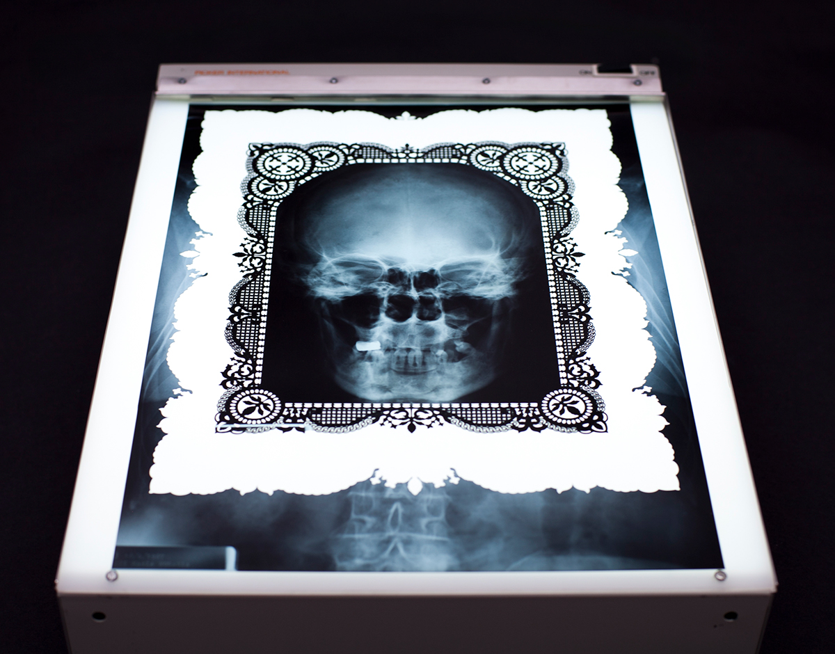 x-rays skeleton lace doilies decoration medical anatomy Lasercut cut