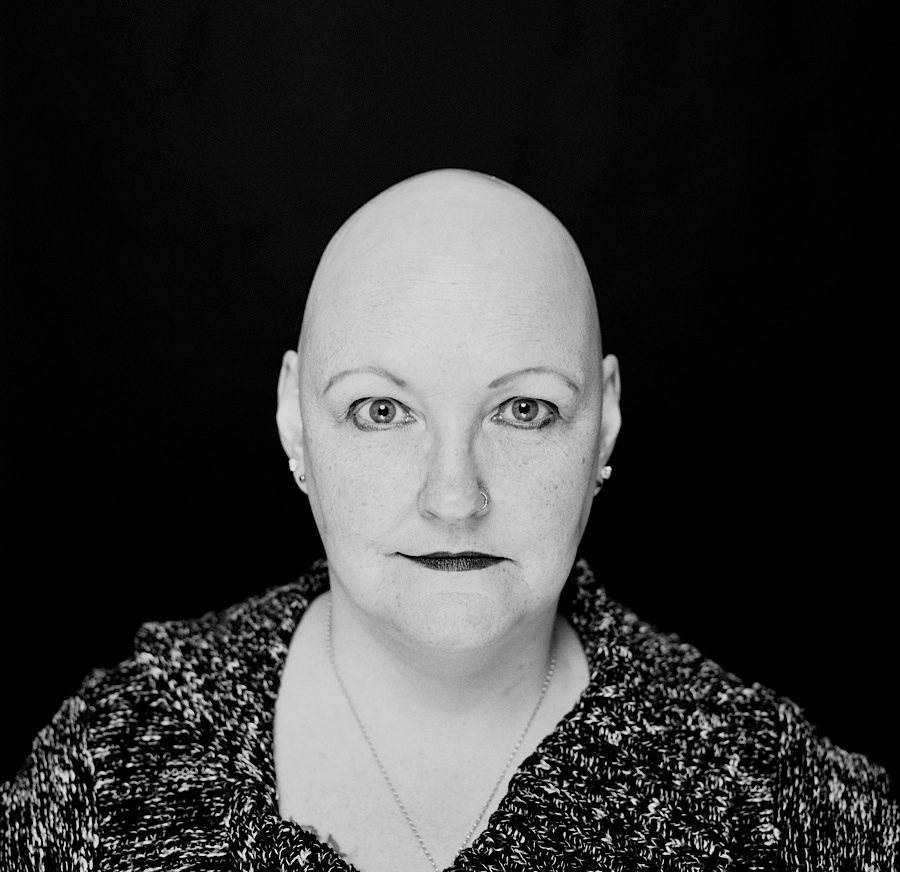 alopecia Portraiture portraits b&w black and white studio lighting photoshop Editing 
