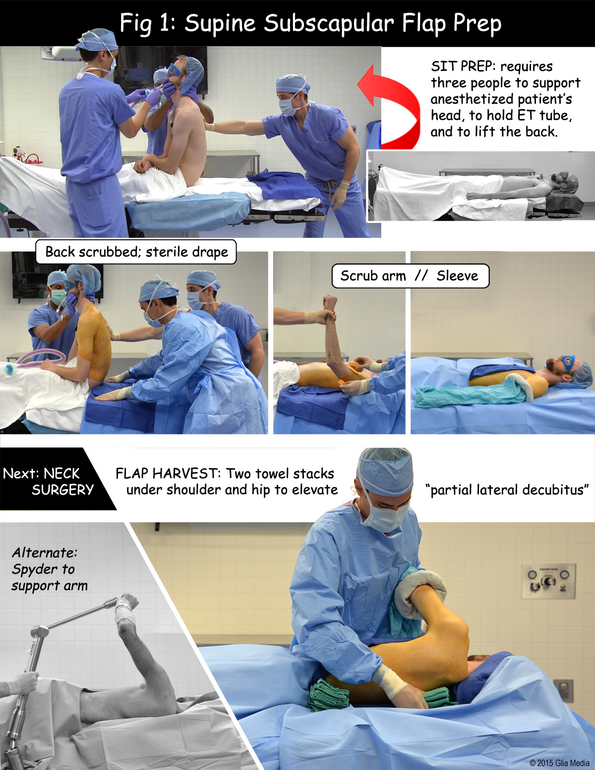 subscapular flap comic surgery