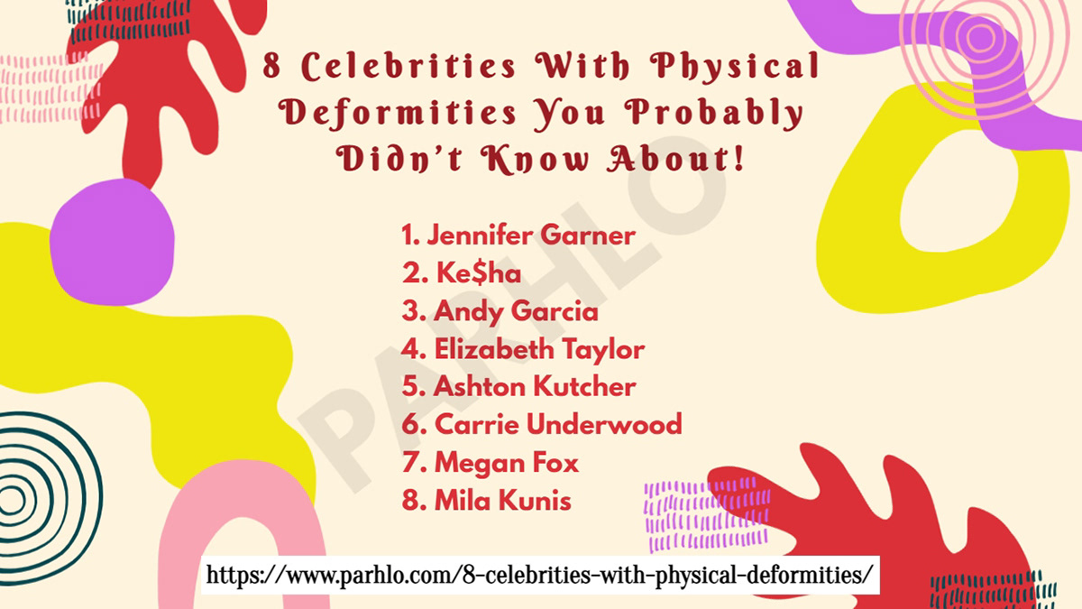 celebrities Celebrity deformity hollywood