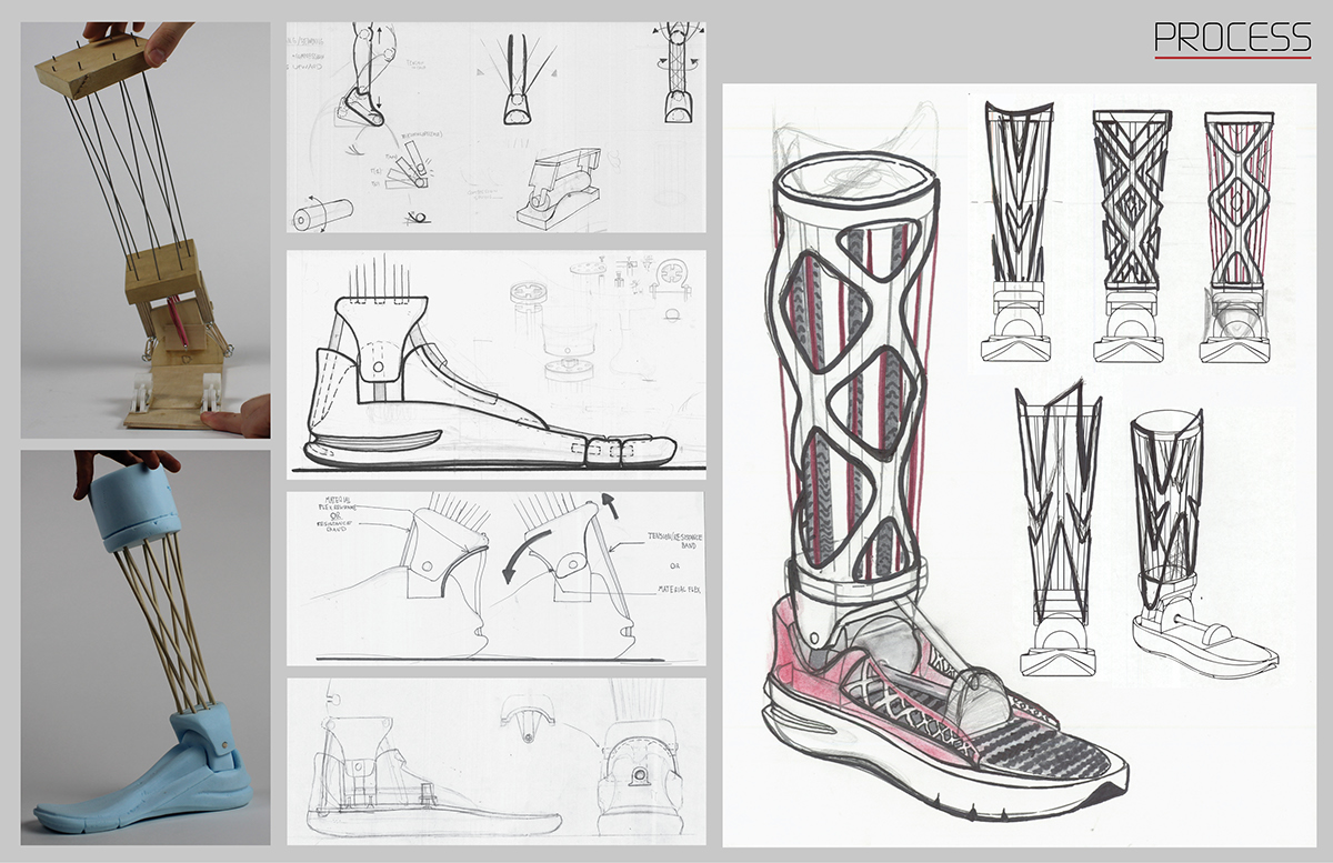 Prosthesis prosthetics leg foot medical design amputee prosthetic leg Performance basketball athletic sport 3D 3d-printed Carbon Fiber