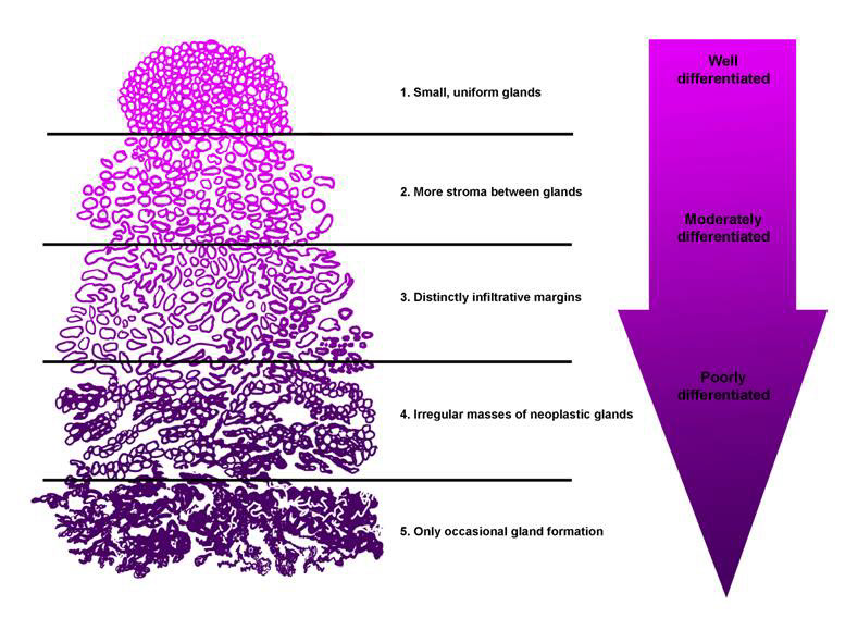 medical illustration medical-legal illustration scientific illustration Pharmaceutical design medical legal biological illustration science surgery biology anatomy human anatomy histology pathology art