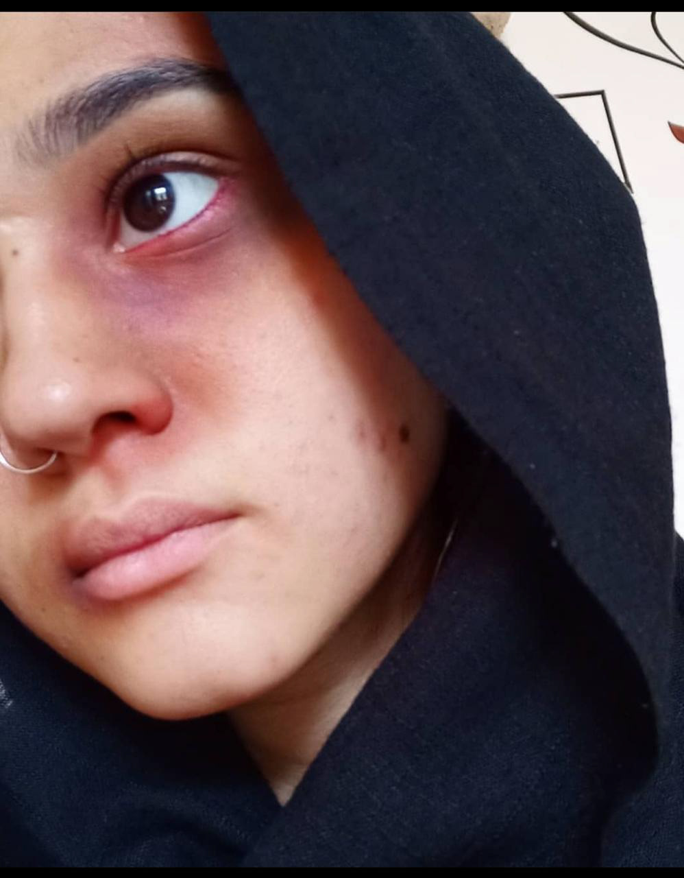 blood Bruise domestic fx makeup injustice Justice makeup pain SFX violence