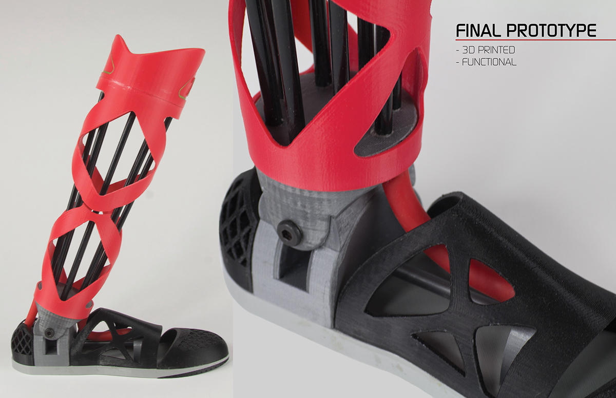 Prosthesis prosthetics leg foot medical design amputee prosthetic leg Performance basketball athletic sport 3D 3d-printed Carbon Fiber