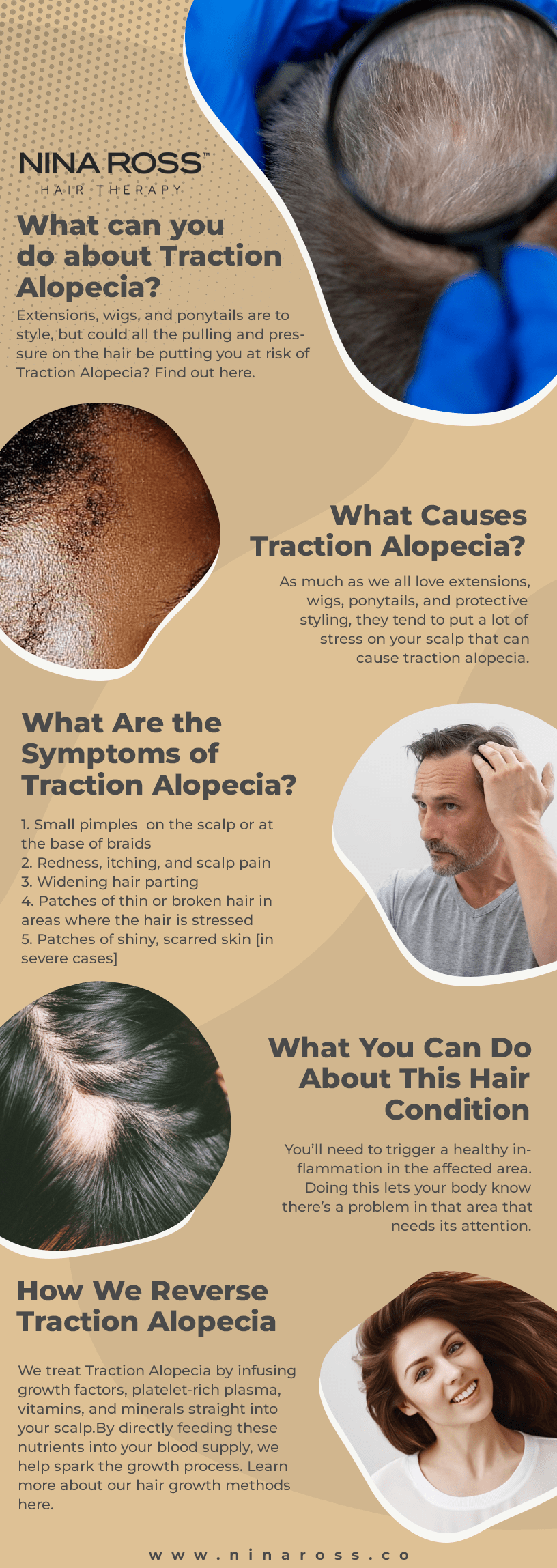 hairloss treatment hairgrowth healthyhair Traction Alopecia