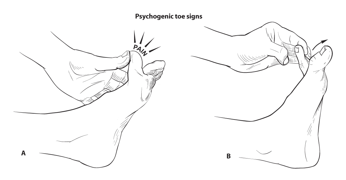 foot feet exam Neurological disorder neurologist neurology