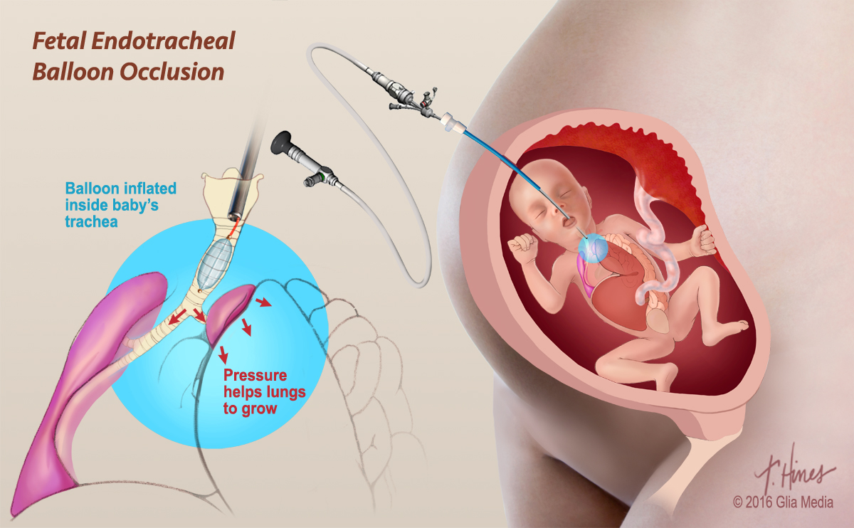 medical illustration surgery anatomy