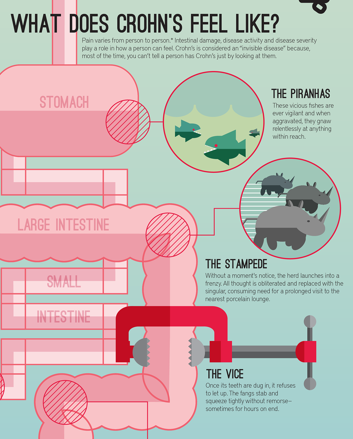 Crohn's intestine IBD vector body brkcrohnsproject infographic crohns Disease metaphor medical diagram poster graphic awareness