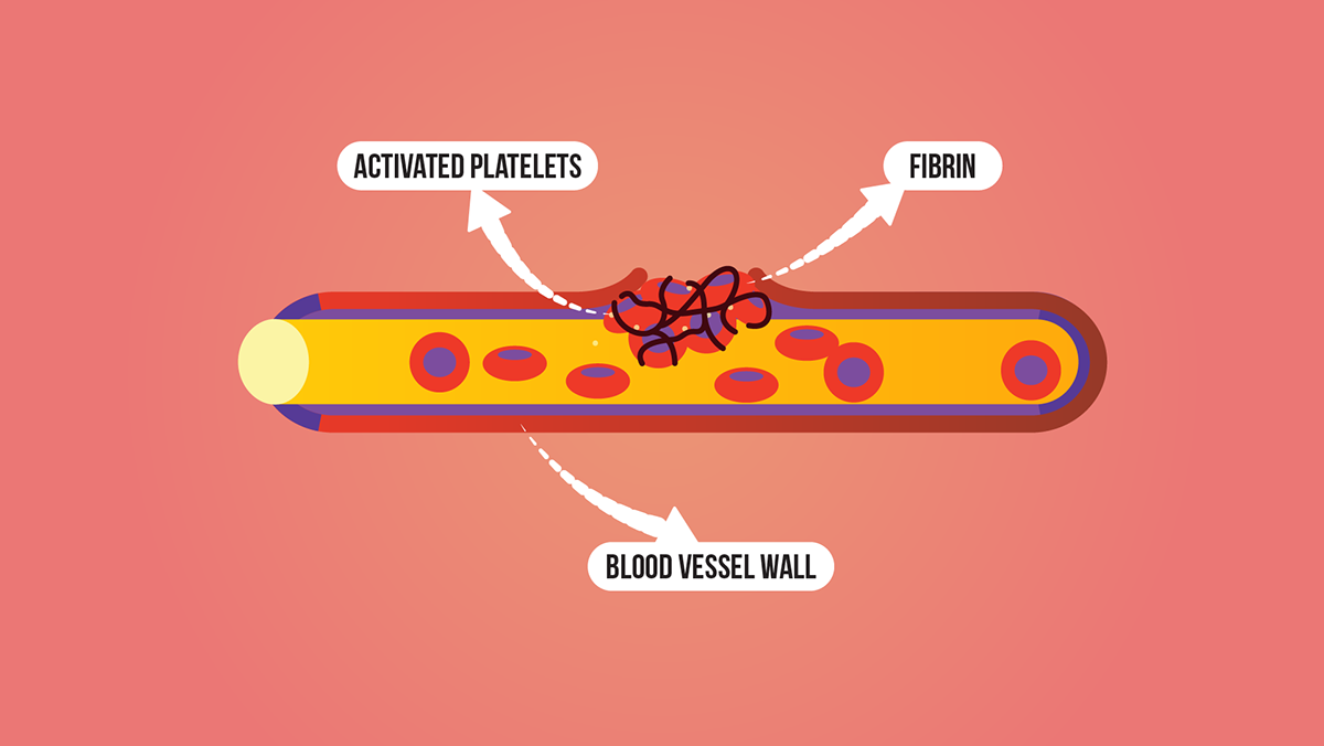 albumin Albumin protein Albumin proteins Fibrinogen Globulins osmosis plasma platelets Red Blood Cells White Blood Cells