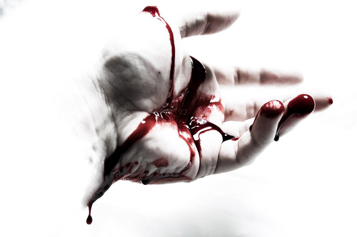 hand blood