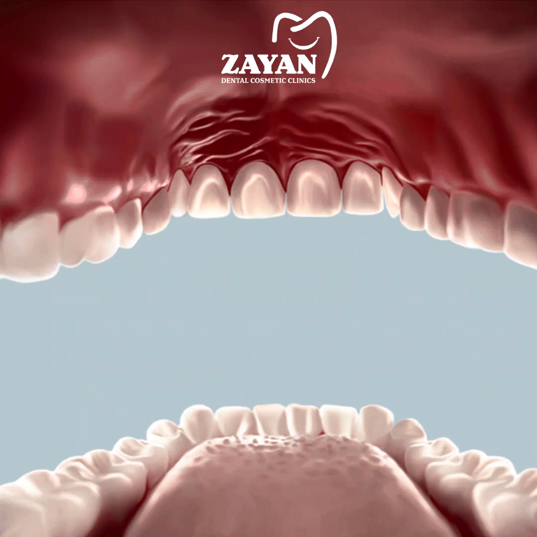 Advertising  clinic Saudi Arabia social media teeth