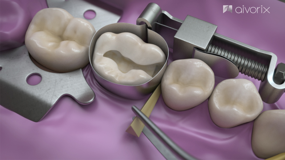 dentistry Education visualeffect computer graphics