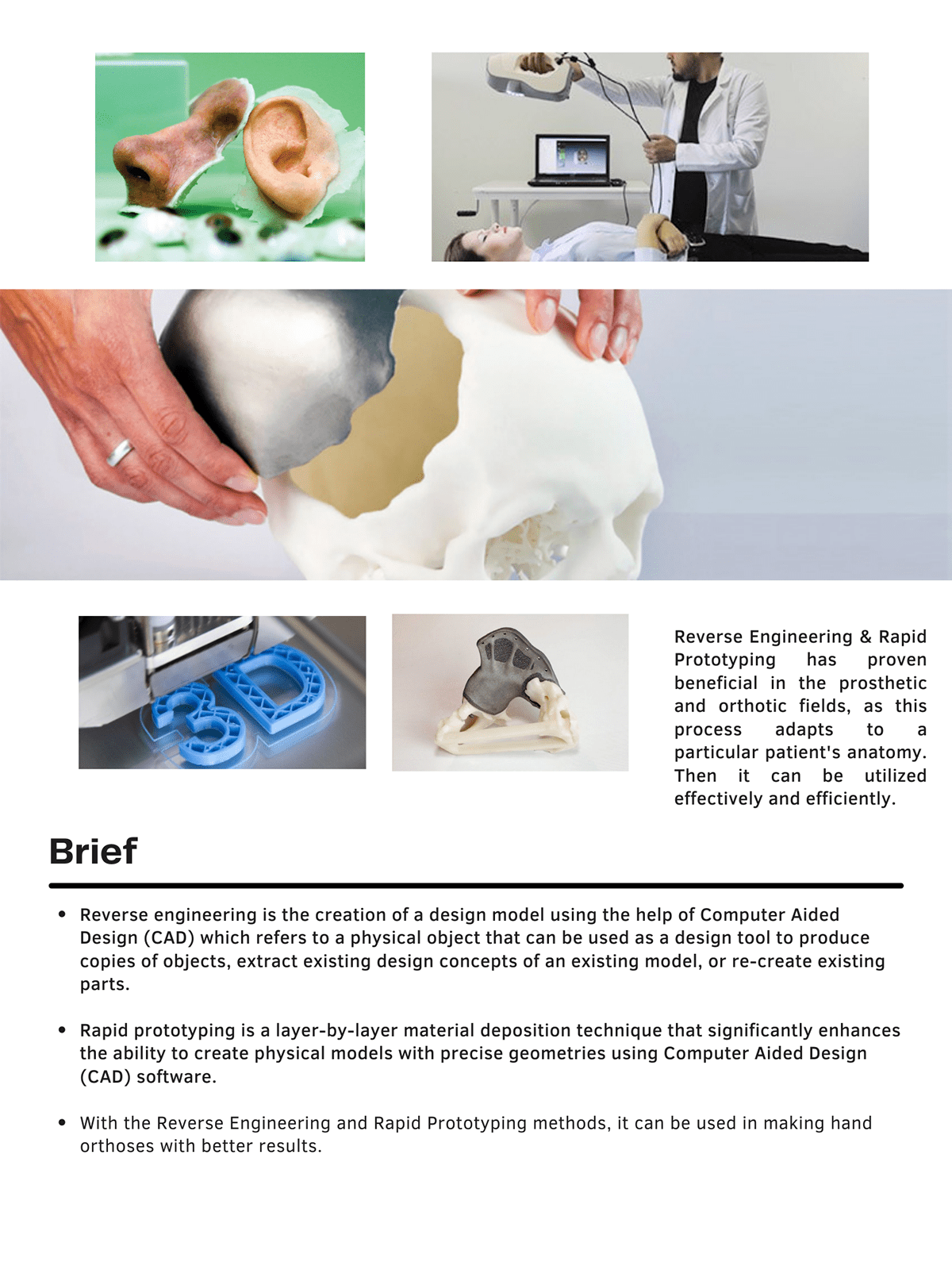 3dprint hand industrialdesign medical orthosis productdesign reverseengineering
