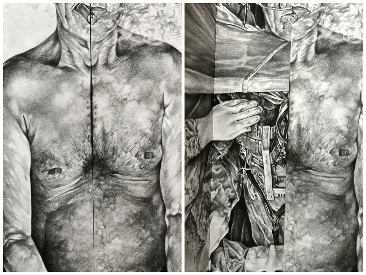 Open Heart Surgery medical illustration surgery graphite pencil Double-Sided risd