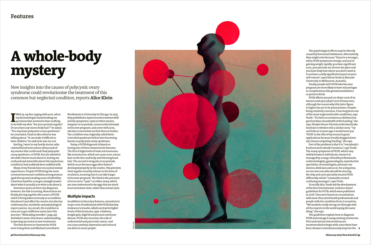Editorial Illustration ILLUSTRATION  new scientist Owen Gent PCOS Polycystic Ovary Syndrome science illustration