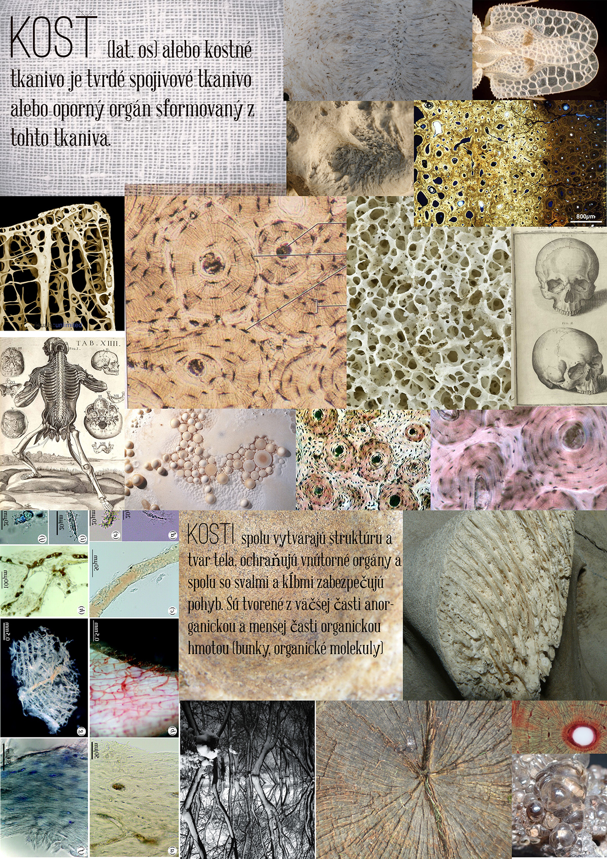 Embroidery bone Osteo tissue micro macro texture structure SEW