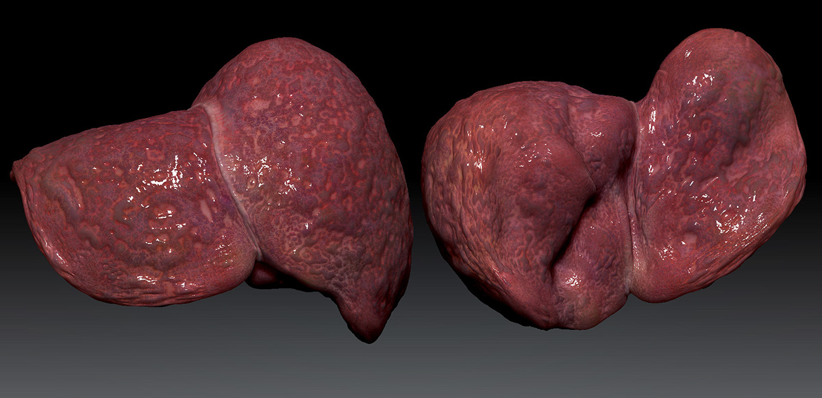 liver печень Medecine science