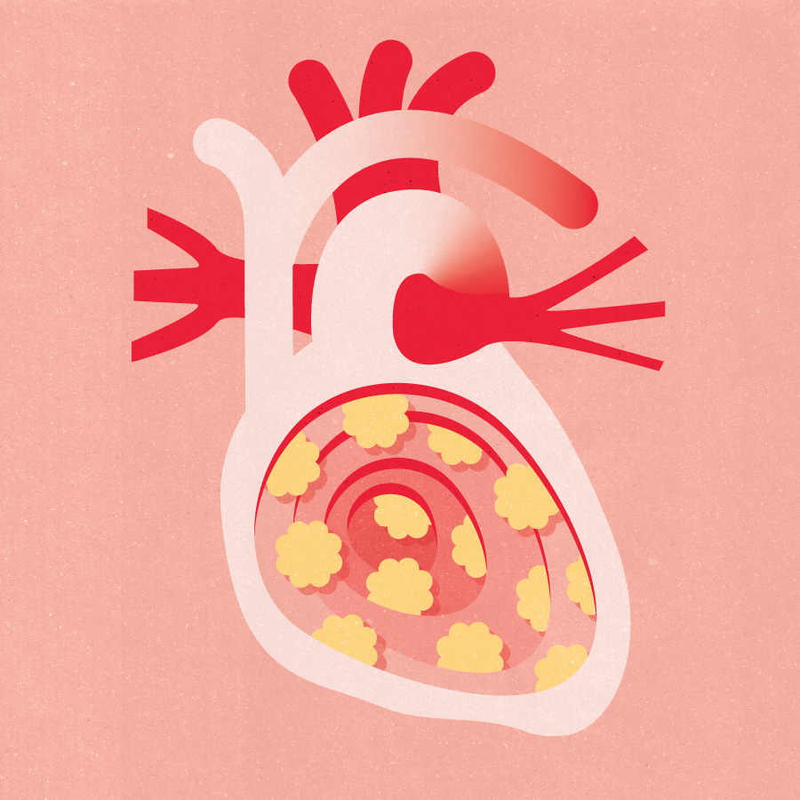 medical medicine Editorial Illustration lungs heart anatomy DNA research Health healthcare