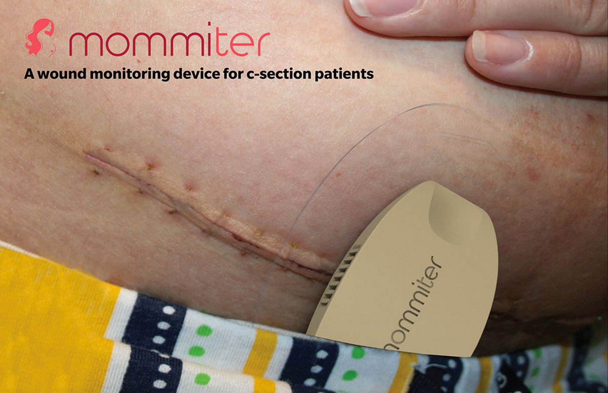 wound Monitoring monitor home healthcare mother surgery post operative app