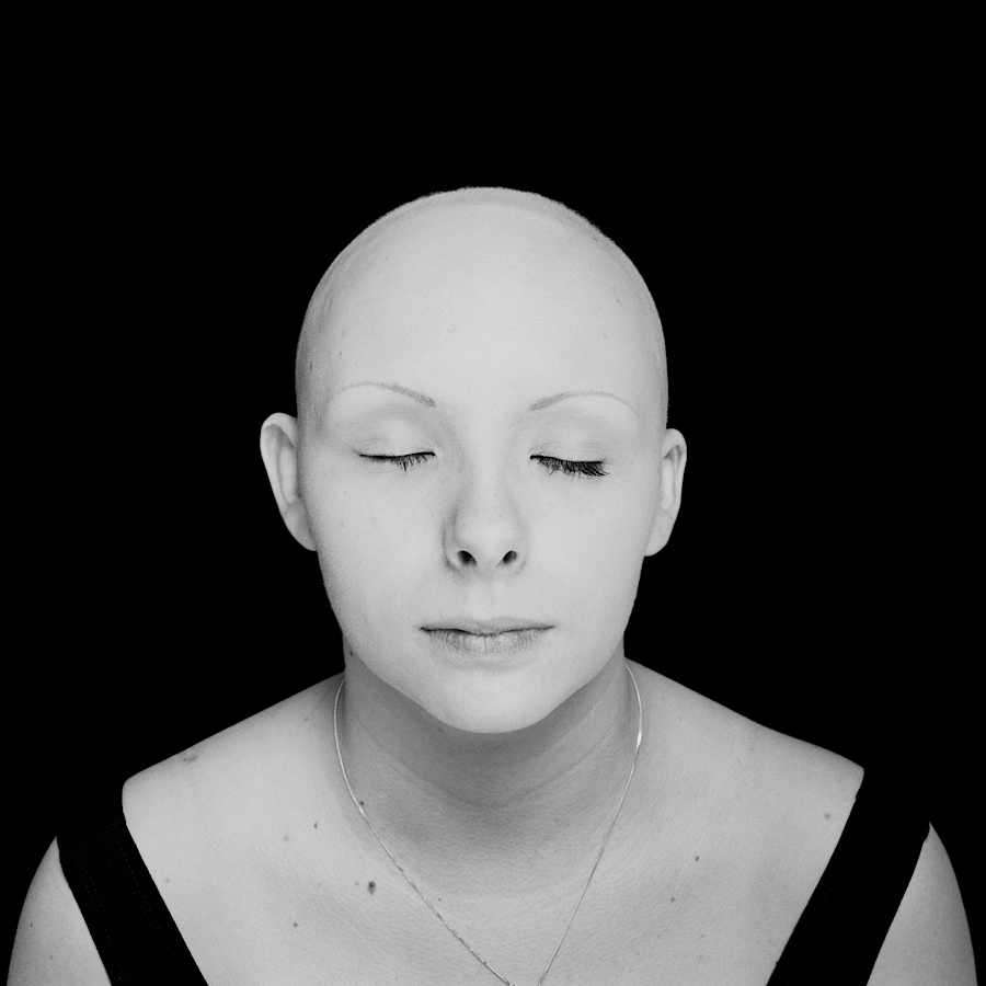 alopecia Portraiture portraits b&w black and white studio lighting photoshop Editing 