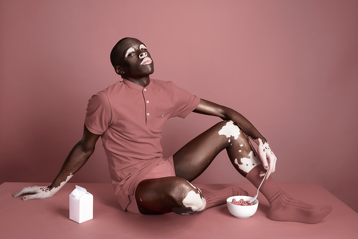 vitiligo art Fashion  skin set design  justin dingwall studio FINEART africa
