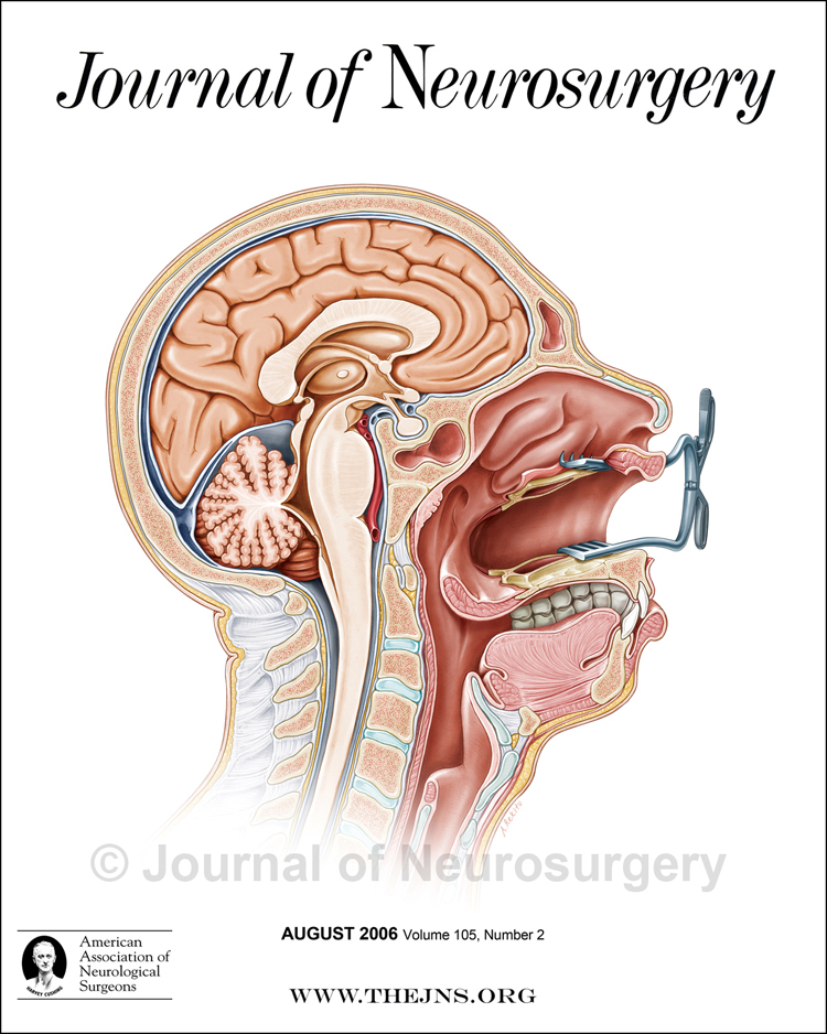 medical illustration neuroanatomy