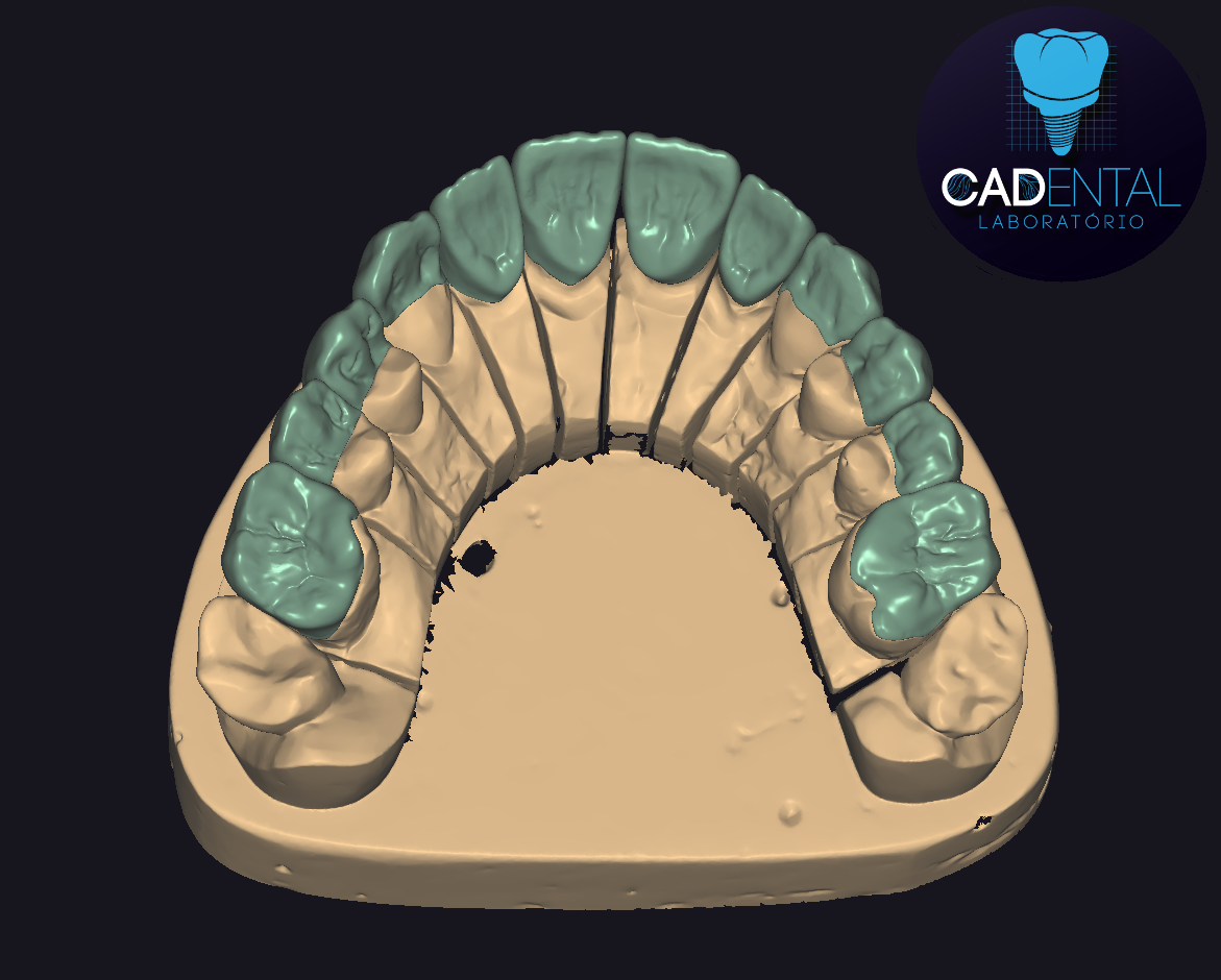 exocad dental dentist teeth dental clinic 3D 3Dprinter cad