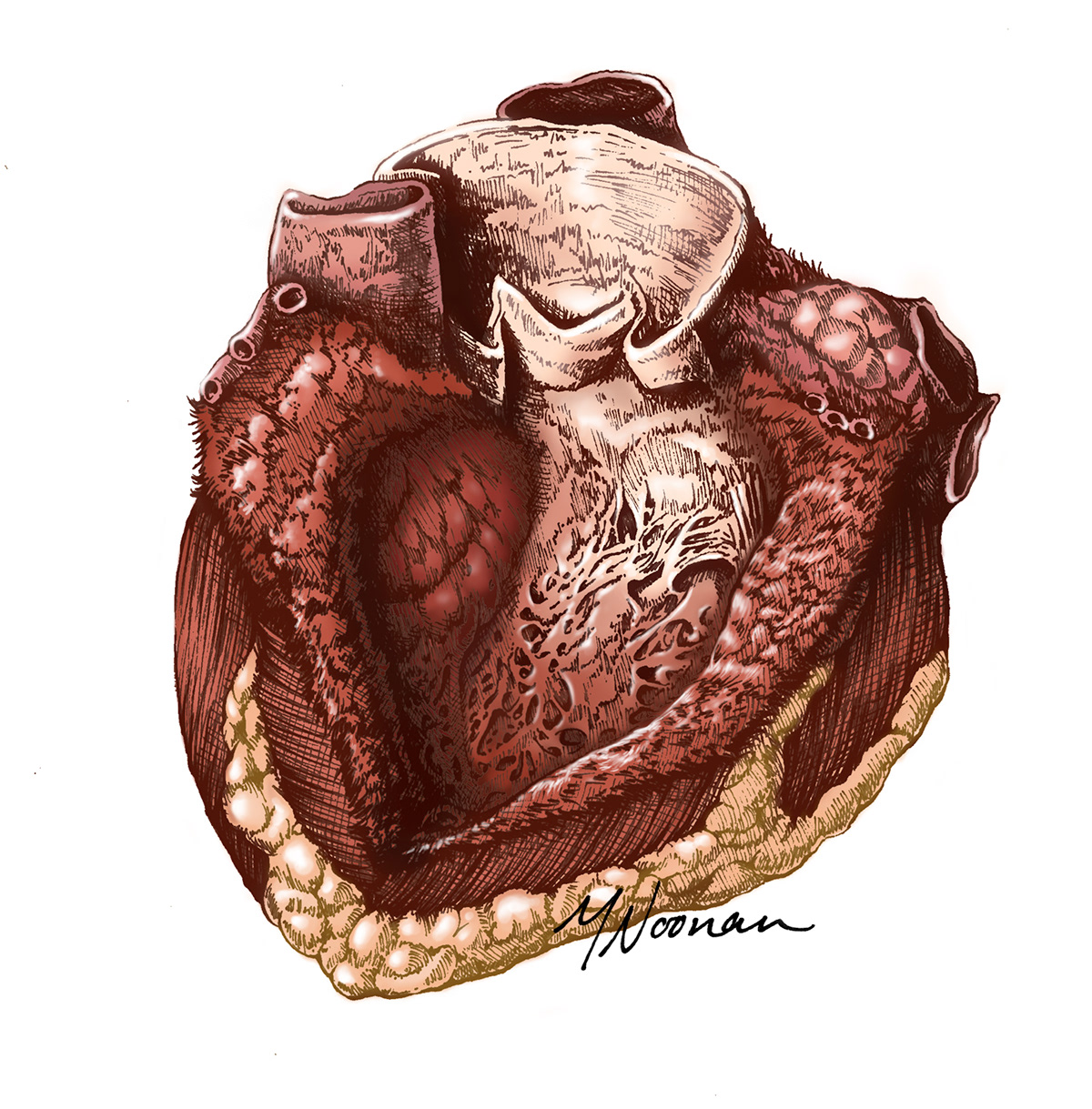heart anatomy cadaver still life ventricle photoshop colorized sketch medical illustration micron technical pen