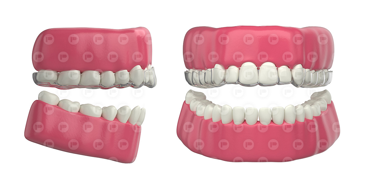3D dental dental clinic Dental Implants Health medical tooth