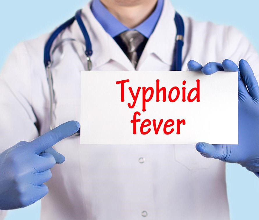 Typhoid Test Typhoid Test at Home