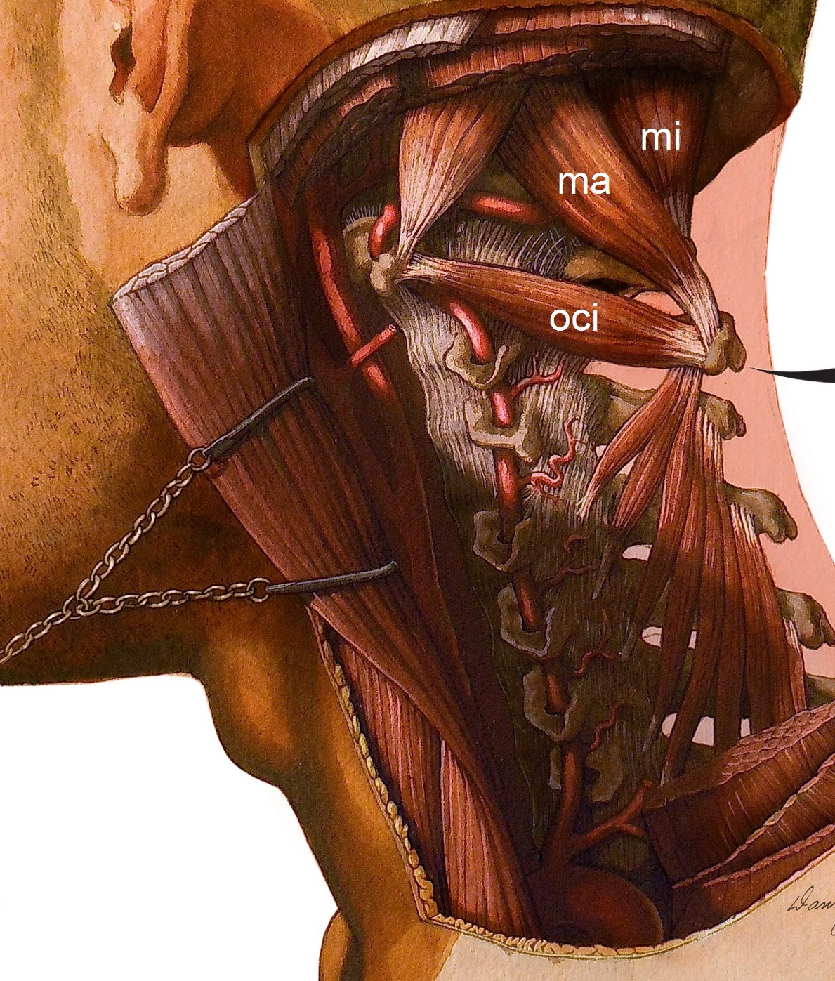 anatomy  Myodural Bridge Dr. Frank Scali suboccipital triangle clinical anatomy  medical illustration Danny Quirk human anatomy dissections origins/insertions watercolors  Scientific Illustration