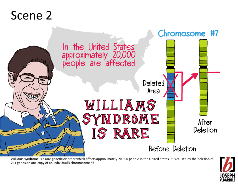 Sindrom Langka - William Syndrome
