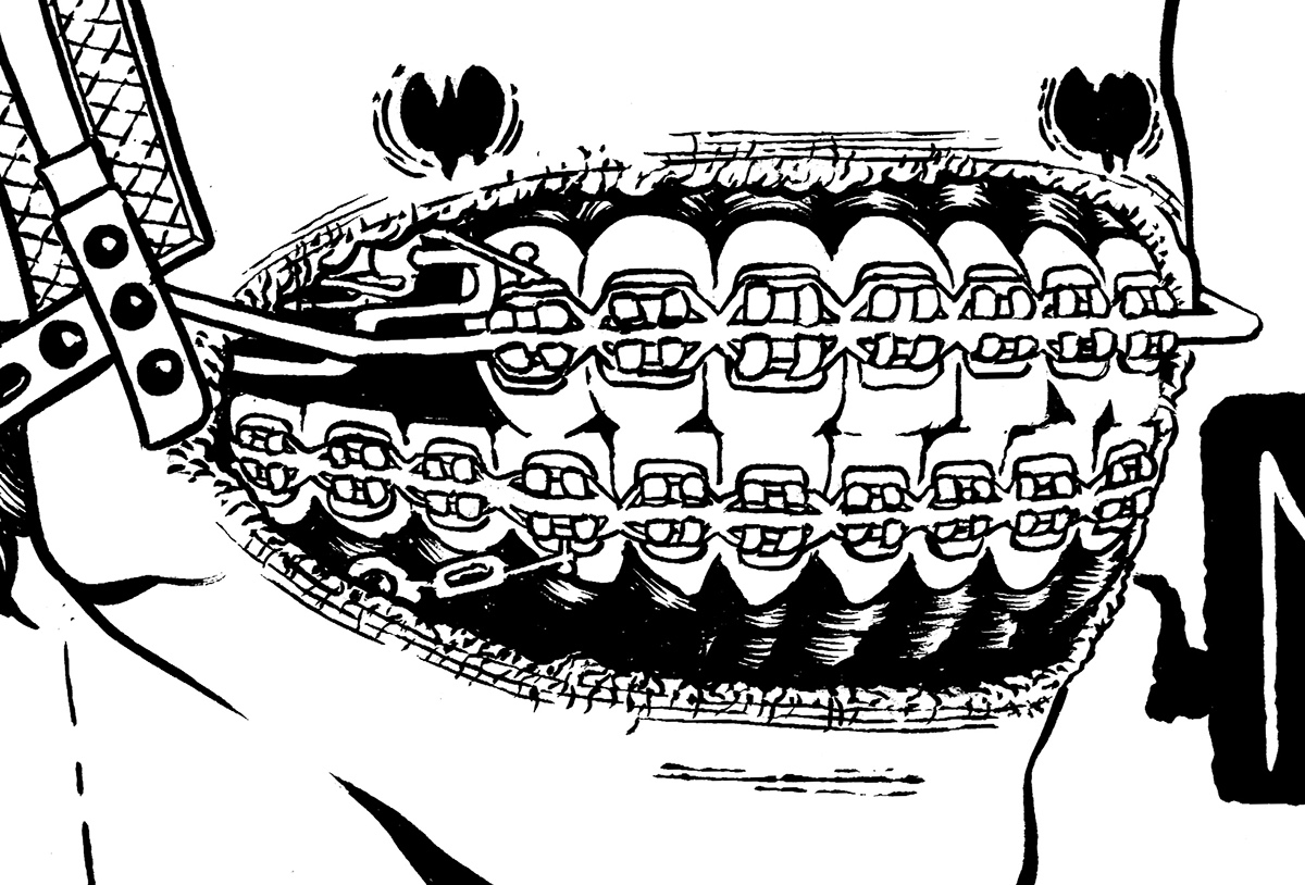 braces boy girl ink aparelho aparelho de dente garoto Garota