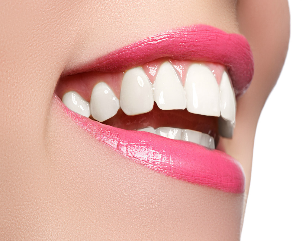 oral health dental care Dental Veneers orthodonist