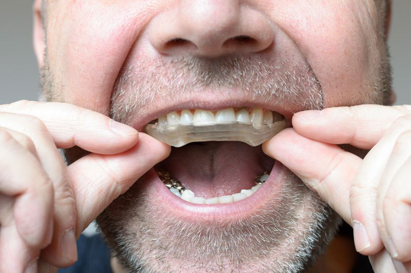 dental care oral health bruxism teeth grinding teeth gums dentist