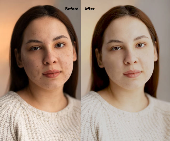 Photo Retouching retouch retouching  face skin photo face retouch beauty Spot Fashion  face sport remove
